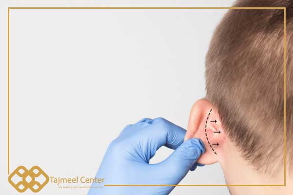 Ear plastic surgery in Türkiye