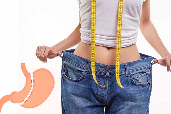 Gastric sleeve surgery in Turkey