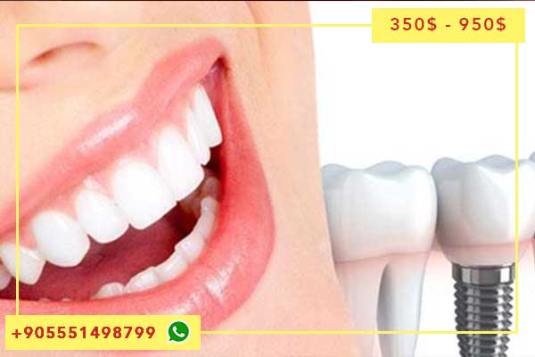 ثمن زراعة الاسنان في تركيا