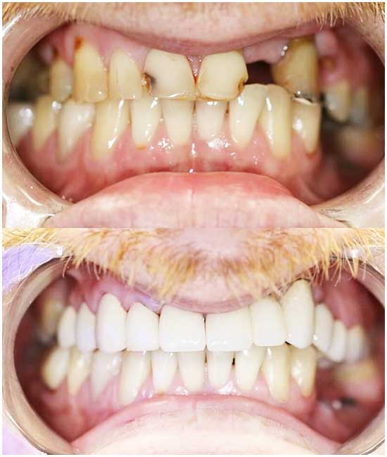 rifarsi i denti in turchia recensioni