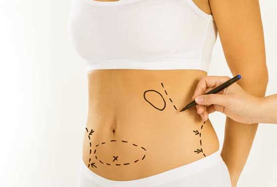 Full body contouring surgery cost Turkey