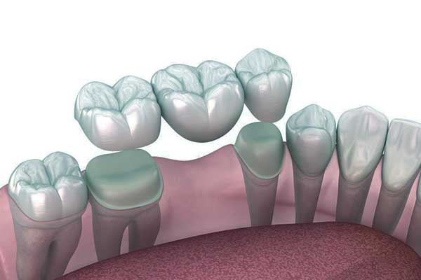 زيمر بيوميت (Zimmer Biomet): كل ما تحتاج معرفته عن الابتكارات الرائدة في تقنيات العظام