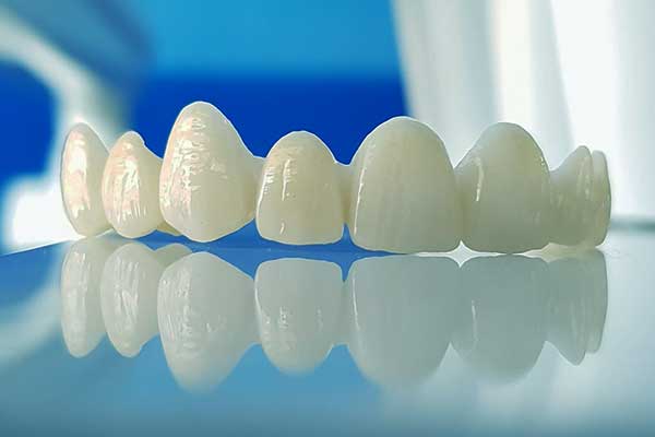 فينير الراتنج (Composite Veneers): كل ما تحتاج لمعرفته حول الكومبوزيت فينير