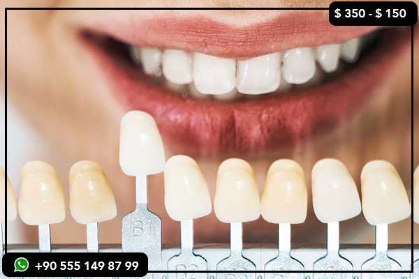 difference between German and Swiss zirconia, benefits of German zirconia, features of Swiss zirconia, types of zirconia for teeth, comparison between zirconia types, best types of zirconia, German zirconia vs Swiss zirconia, cost of zirconia teeth, zirconia teeth German and Swiss