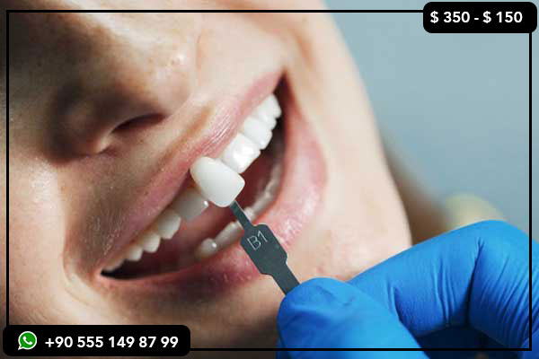 Implants dentaires Turquie, Facettes dentaires Turquie, Dents en Turquie, Sourire Hollywood Turquie, Meilleur dentiste en Turquie, Clinique dentaire Turquie, Relooking des dents en Turquie, Blanchiment des dents Turquie, Restauration complète de la bouche Turquie, Relooking du sourire Turquie, Implants dentaires bon marché Turquie, Facettes abordables Turquie, Meilleures cliniques dentaires en Turquie, Tourisme dentaire Turquie, Voyage dentaire en Turquie, Blanchiment des dents Turquie, Facettes en porcelaine Turquie, Couronnes en zircone Turquie, Implants All-on-4 Turquie, Implants All-on-6 Turquie, Meilleurs centres dentaires en Turquie, Prix dentaires en Turquie, Coût des dents en Turquie, Traitement dentaire à l'étranger, Prix dentaires Turquie vs Arabie saoudite, Dentisterie bon marché en Turquie, La Turquie est-elle sûre pour les soins dentaires, Meilleures villes pour les soins dentaires en Turquie, Forfaits touristiques dentaires en Turquie, Meilleures offres de dents en Turquie, Comment réserver un voyage dentaire en Turquie, Pourquoi choisir la Turquie pour un traitement dentaire