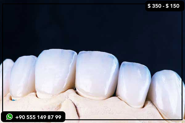 Precios de servicios dentales en los Emiratos Árabes Unidos, servicios dentales en Turquía, tratamiento dental en Turquía, precios dentales en los Emiratos Árabes Unidos frente a Turquía, dientes en Turquía, implantes dentales en Turquía, carillas en Turquía, sonrisa de Hollywood en Turquía, cambio de imagen de los dientes en Turquía, mejor clínica dental en Turquía, restauración de boca completa en Turquía, turismo dental en Turquía, implantes dentales baratos en Turquía, mejores carillas en Turquía, viaje dental en Turquía, tratamientos dentales asequibles, vacaciones dentales en Turquía, costo de implantes dentales en los Emiratos Árabes Unidos, atención dental en Turquía frente a los Emiratos Árabes Unidos, blanqueamiento dental en Turquía, cambio de imagen de sonrisa en Turquía, coronas de circonio en Turquía, mejores dentistas en Turquía