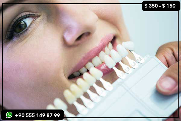 dental services prices Germany, dental implants Germany vs Turkey, veneers cost Germany vs Turkey, Turkey dental tourism, best dental clinics Turkey, affordable dental treatment Turkey, Hollywood smile Turkey, Turkey teeth, teeth whitening Turkey, full mouth restoration Turkey, dental treatment abroad, dental tourism Europe, cheapest dental implants, cost of dental work Turkey, Turkey smile makeover, dental clinics in Turkey, dental implants cost comparison, Germany dental treatment cost, Turkey dental vacation, best dentist in Turkey