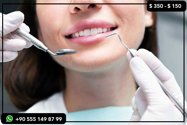 dental services prices in France, dental treatments in Turkey, Turkey teeth, dental implants Turkey, veneers Turkey, Turkey teeth makeover, dental tourism Turkey, best dental clinics in Turkey, affordable dental care Turkey, smile makeover Turkey, teeth whitening Turkey, full mouth restoration Turkey, porcelain veneers Turkey, best dentist in Turkey, Turkey vs France dental costs, dental trip to Turkey, cosmetic dentistry Turkey, Hollywood smile Turkey