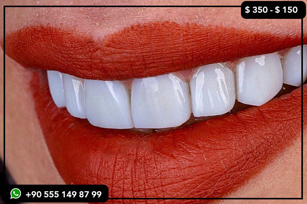 dental implant cost Netherlands, dental implant price Turkey, dental veneers Netherlands, dental veneers Turkey, Turkey dental tourism, dental care abroad, Netherlands vs Turkey dental, cheap dental implants, best dental clinics in Turkey, all-on-4 implants cost, dental holiday in Turkey, quality dental treatments, affordable dental care, medical tourism Turkey