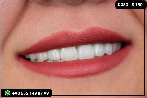 impianti dentali Belgio, impianti dentali Turchia, faccette dentali Belgio, faccette dentali Turchia, sbiancamento denti Belgio, sbiancamento denti Turchia, turismo odontoiatrico, cure odontoiatriche convenienti, migliori cliniche odontoiatriche Turchia, cure odontoiatriche all'estero, costi odontoiatrici Turchia vs Belgio, risparmi odontoiatrici, confronto cure odontoiatriche, turismo medico Turchia, cure odontoiatriche di alta qualità