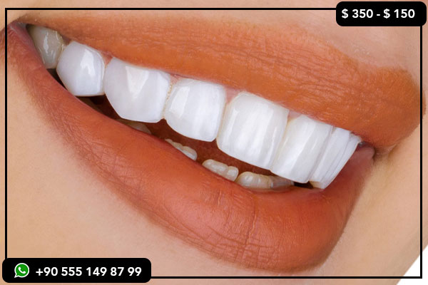 dental tourism, dental implants, dental veneers, Turkey dental services, Romania vs Turkey dental prices, best dental clinics in Turkey, affordable dental treatments, zirconium crowns, all-on-4 implants, teeth whitening, dental tourism packages, medical tourism in Turkey, dental treatment cost comparison, high-quality dental care