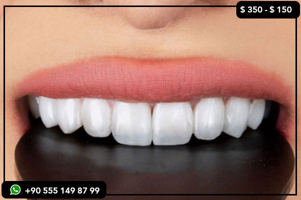 comparación de servicios dentales, precios dentales Rusia vs Turquía, turismo dental Turquía, implantes dentales asequibles, carillas dentales Turquía, mejores clínicas dentales Turquía, por qué elegir Turquía para el cuidado dental, costo dental Turquía vs Rusia, beneficios del turismo dental, costo de implantes dentales Turquía