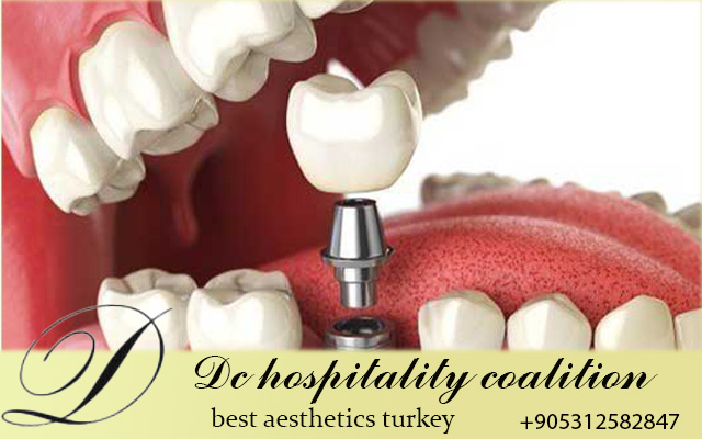 Лучший стоматолог в Турции
