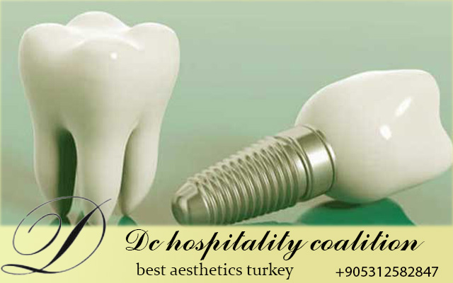 Лучшая стоматология в Турции