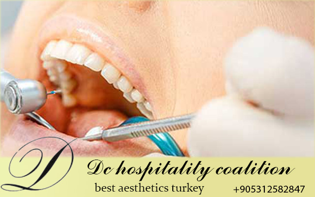 Частная стоматология в Турции: Полное руководство 2025 года для идеальной улыбки