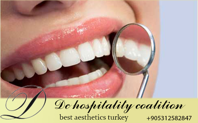 Виниры в Турции 2026: Полное Руководство по Голливудской Улыбке